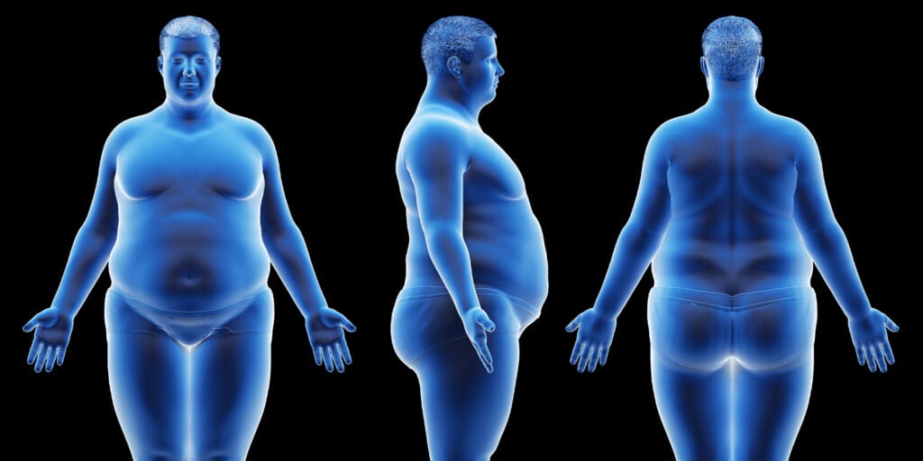 Roundness index linked to depression risk in people with dementia