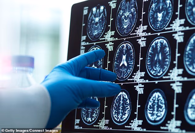 New test may bring brain cancer diagnosis down to hours