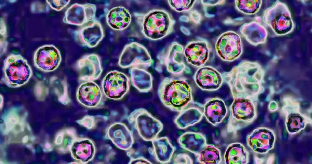 Wisconsin county records 10 confirmed measles cases