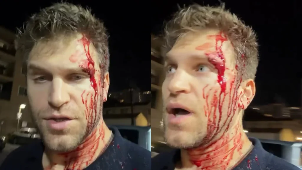 Keegan Allen of Pretty Little Liars attacked, robbed at gunpoint