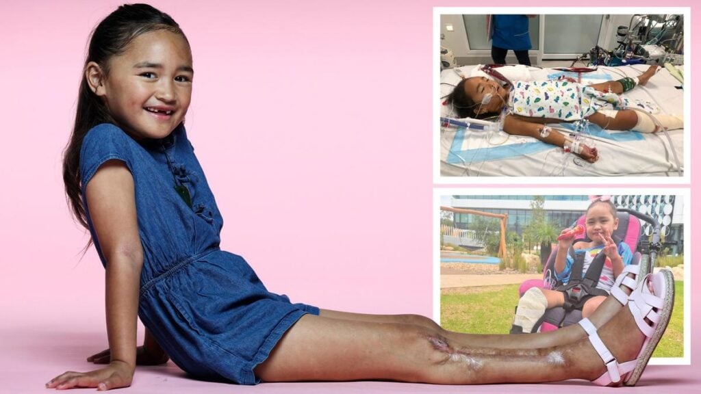 Bubba Kaio Rerekura’s life saved through Telethon support