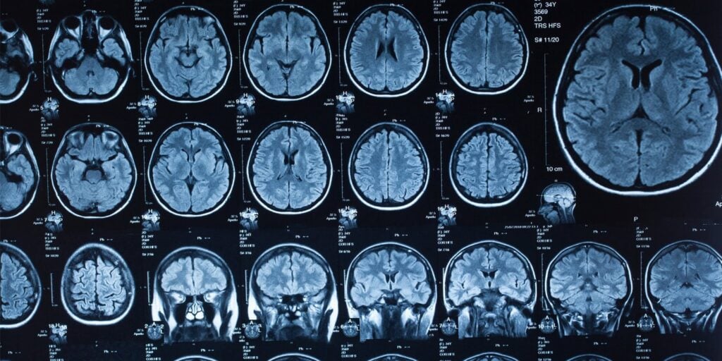 Experts map link between polluted air and children’s brain wiring