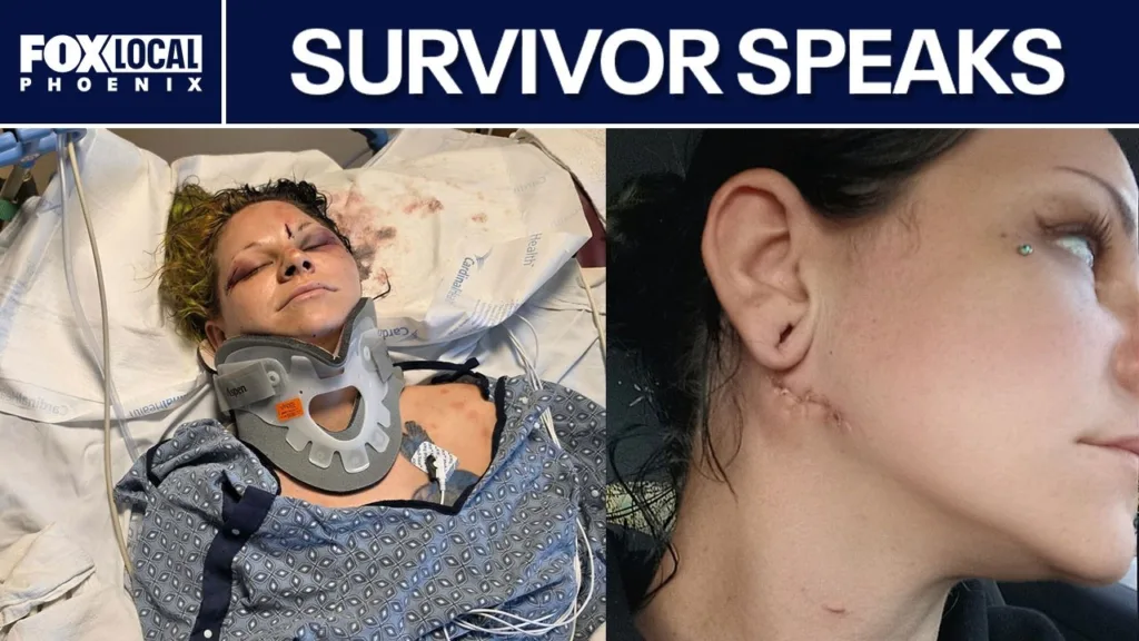 Glendale woman recounts surviving fiancé’s scissors attack